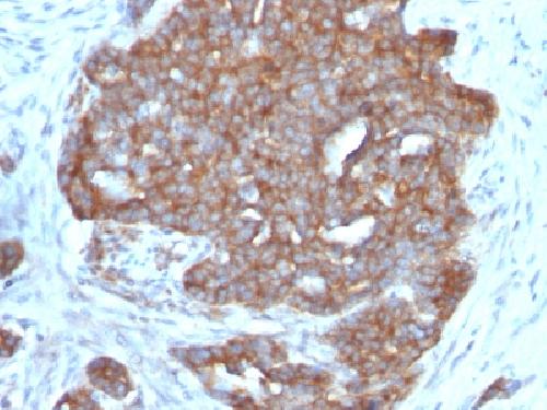 TFF1 Antibody