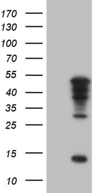 TFIIB Antibody