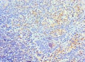 TFPI2 Antibody