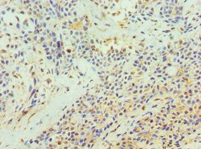 TFPI2 Antibody