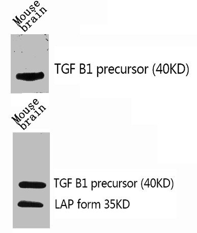 TGFB1 Antibody