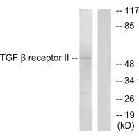 TGFBR2 Antibody