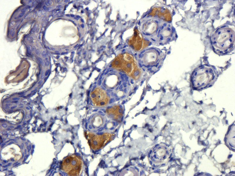 TGF beta 1 antibody