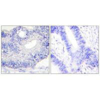 TGFA Antibody