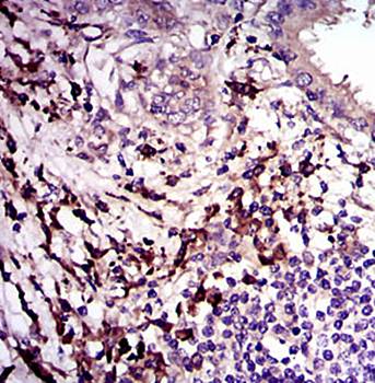 TGFb1 Antibody