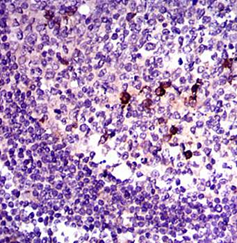 TGFb1 Antibody