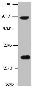 TGM2 Antibody