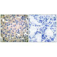 TGM2 Antibody
