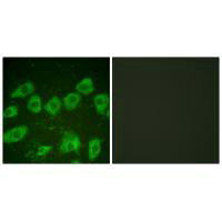 TH Antibody