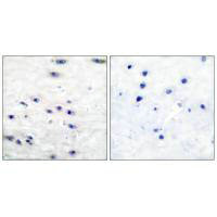 TH Antibody