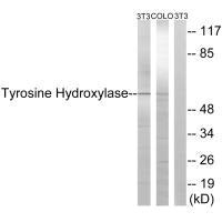 TH Antibody