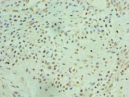 THOC1 Antibody