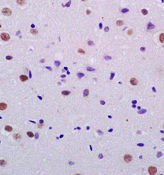 Nuclear Matrix Protein p84 Rabbit Polyclonal Antibody