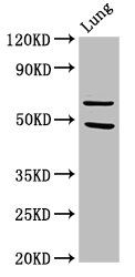 PAK4 Antibody