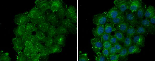 thrombomodulin Antibody