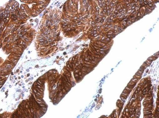 thrombomodulin Antibody