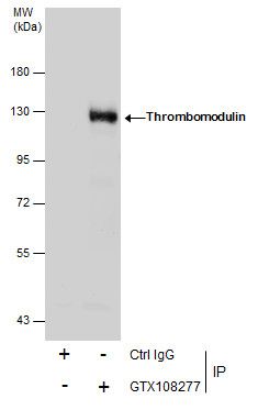 thrombomodulin Antibody