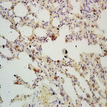 TIGAR Rabbit Polyclonal Antibody