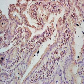 TIGAR Rabbit Polyclonal Antibody