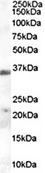 TIM3/HAVCR2 Antibody