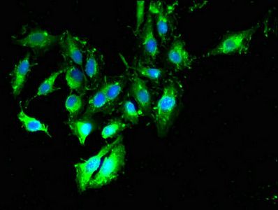 TIMD4 Antibody