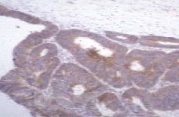 Mouse anti Human Tissue Inhibitor of Matrix Metalloproteinase 1 (TIMP-1) Antibody