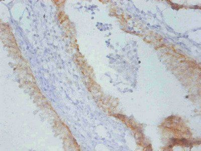 Timp1 Antibody