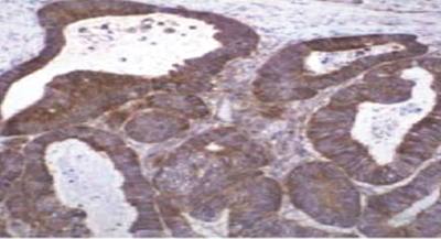 Mouse Human Tissue Inhibitor of Matrix Metalloproteinase 2 (TIMP2) Antibody