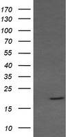 TIMP2 Antibody
