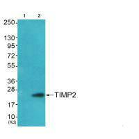 TIMP2 Antibody