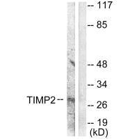 TIMP2 Antibody