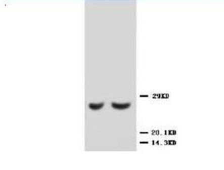 Metalloproteinase inhibitor 2 TIMP2 Rabbit Polyclonal Antibody