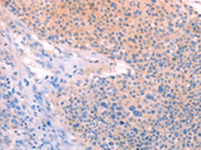 TIMP4 Antibody