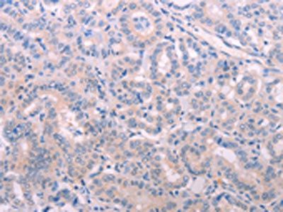 TIMP4 Antibody