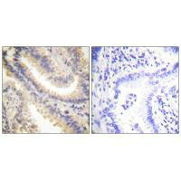 TIMP4 Antibody