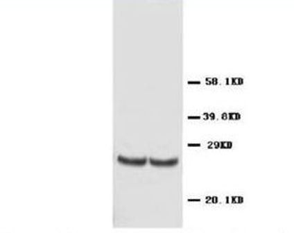 Metalloproteinase inhibitor 4 TIMP4 Rabbit Polyclonal Antibody