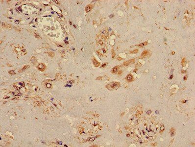 TINF2 Antibody