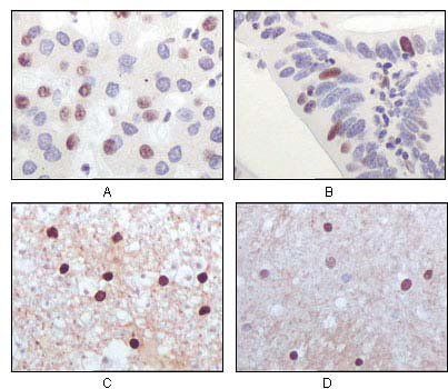 TIP60 Antibody