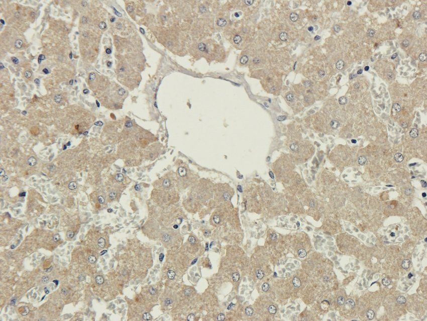 TIRAP Rabbit Polyclonal Antibody