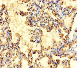F3 Antibody