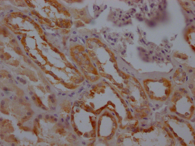 F3 Antibody