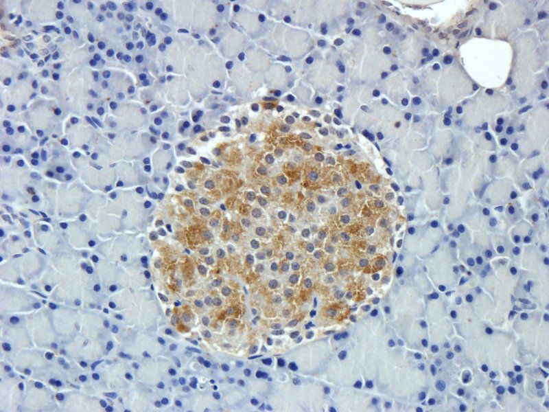 Tissue Factor antibody