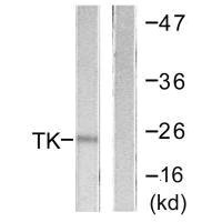 TK1 Antibody
