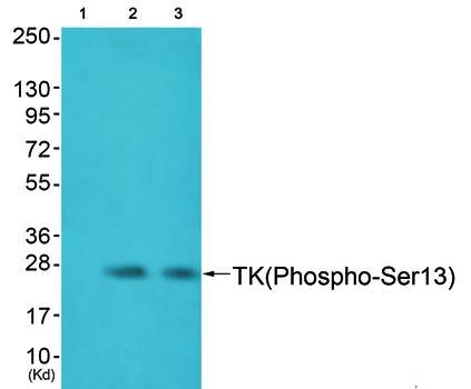TK (Phospho-Ser13) Antibody