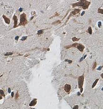 TLE4 Rabbit Polyclonal Antibody