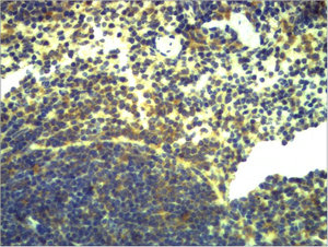 TLR2 Antibody