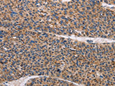 TLR8 Antibody