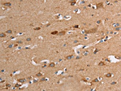 TLR8 Antibody