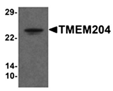 TMEM204 Rabbit Polyclonal Antibody