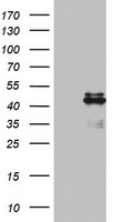 TMS1 Antibody